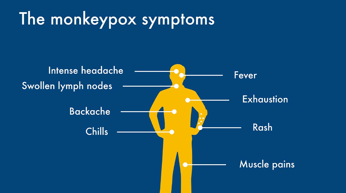 Symptoms of Monkeypox Workplace Graphic